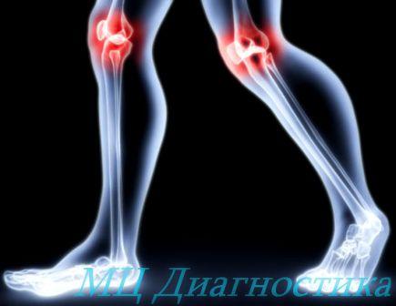 Заболевания суставов большого пальца ноги гнойние лечение. Воспаление сустава большого пальца ноги: причины и лечение Артрит пальцев ног: симптомы заболевания и лечение — Медицинский портал. Сильная боль в суставе большого пальца на ноге: лечение и профилактика
