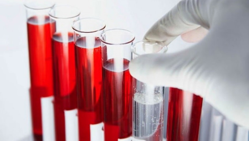Расшифровка анализа крови